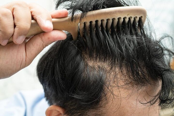 Exploring the best clinics for advanced hair restoration